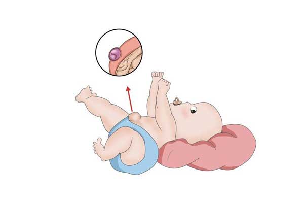 新生儿脐带 保持新生儿脐带清洁 新生儿脐带护理