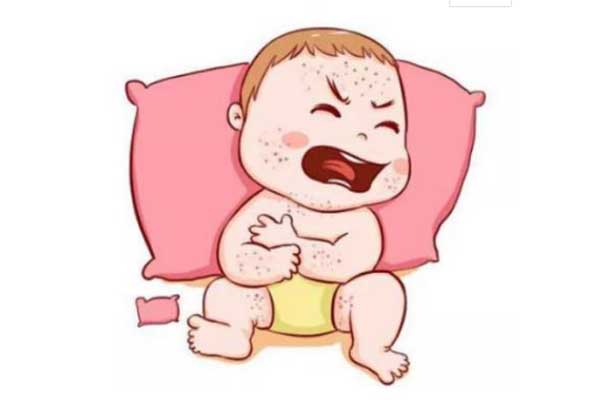 新生儿湿疹可以用炉甘石洗剂吗 新生儿湿疹使用炉甘石洗剂的方法 新生儿湿疹的治疗方法