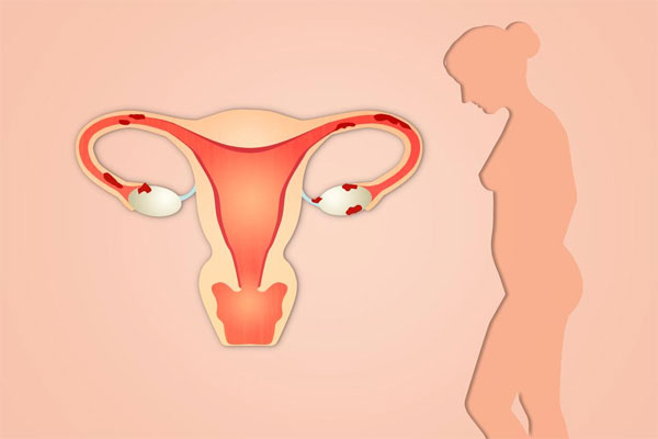 女性子宫内膜过薄原因 子宫内膜过薄的危害 子宫内膜过薄症状