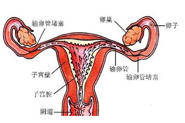 输卵管疏通方法 振东女性健康