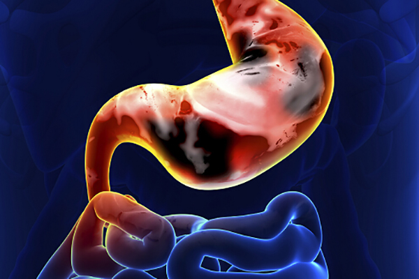 肠胃 吃什么养胃 肠胃炎