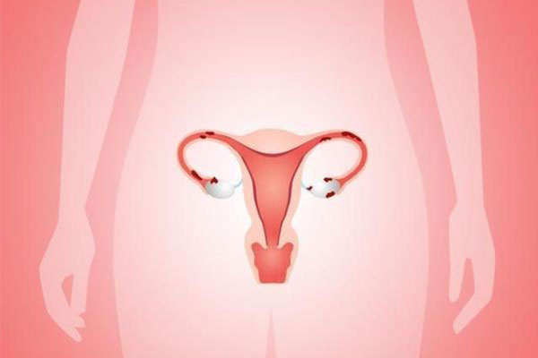 宫颈息肉怎么治疗 女性健康