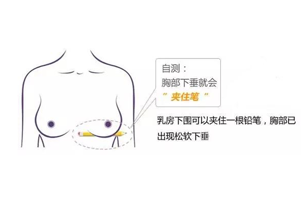 乳房下垂自测