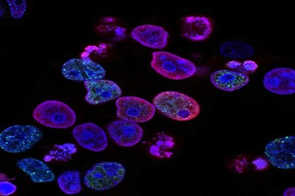 EGFR突变分组 非小细胞肺癌