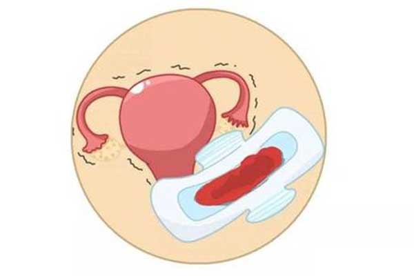 比如月经不调,附件炎等等,宫颈癌早期同样会出现阴道无规则出血的症状