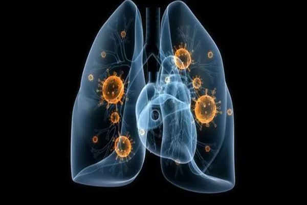 肺癌,肺癌的诱因