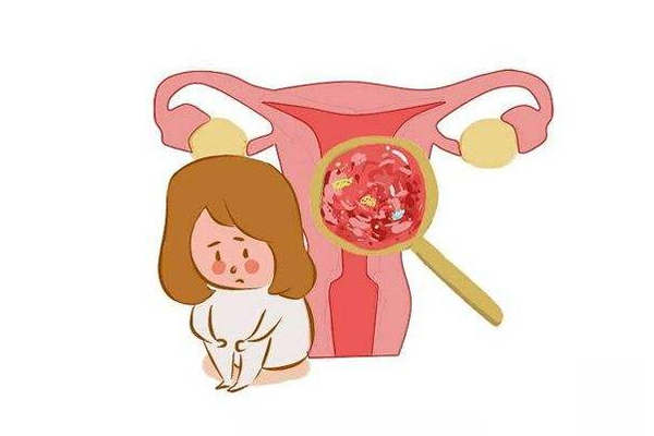 子宫肌瘤,子宫肌瘤的症状