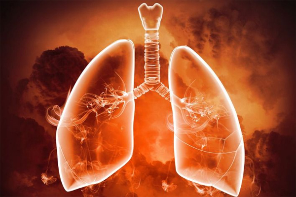 肺癌症状,肺癌的早期症状有哪些