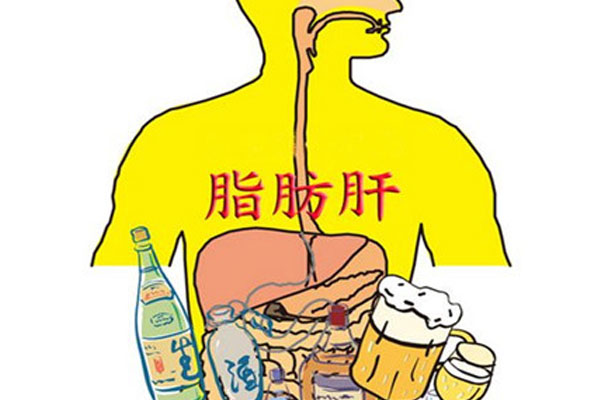 酒精性脂肪肝与非酒精性脂肪肝有什么不同