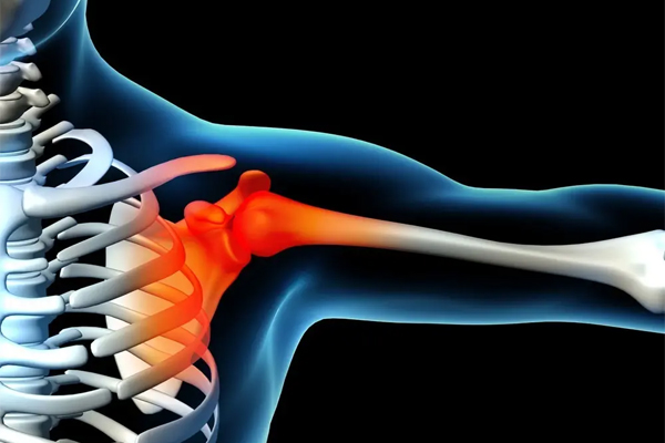 肩周炎,缓解肩周炎的方法