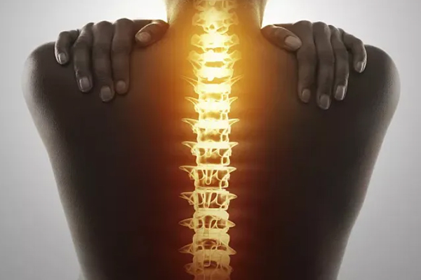 强直性脊柱炎,强直性脊柱炎的症状