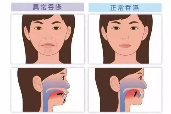 儿童脑脊髓炎,儿童脑脊髓炎病发,振东健康