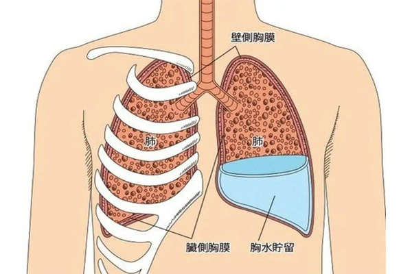 白肺症状表现,白肺症状表现产生,振东健康