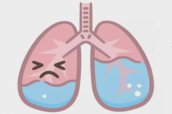 肺水肿,肺水肿的原因