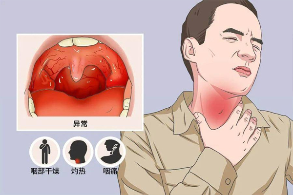 慢性咽炎,慢性咽炎的原因,慢性咽炎的诱因