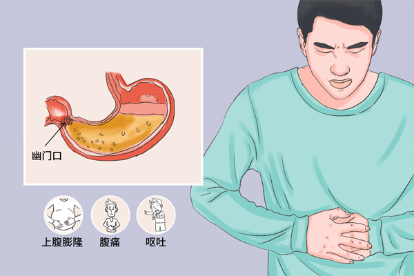 胃溃疡症状,胃溃疡发作症状,胃溃疡并发症,振东健康