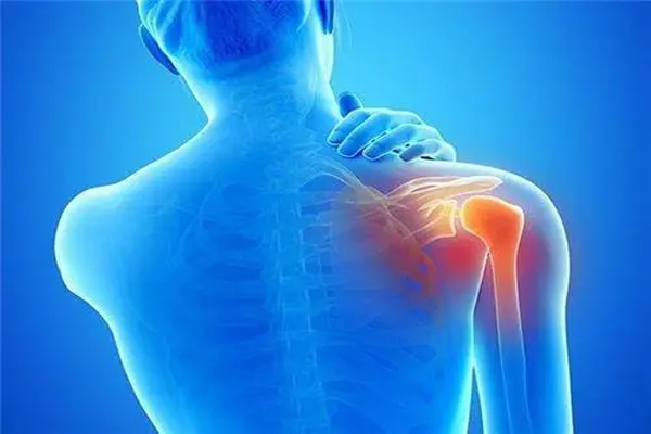 肩周炎,肩周炎的原因,导致肩周炎的原因