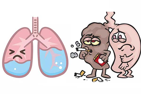 肺水肿,什么是肺水肿,预防肺水肿,如何预防肺水肿,