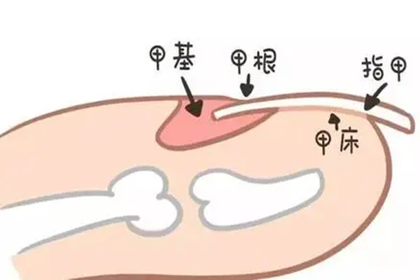 灰指甲,灰指甲症状,振东健康