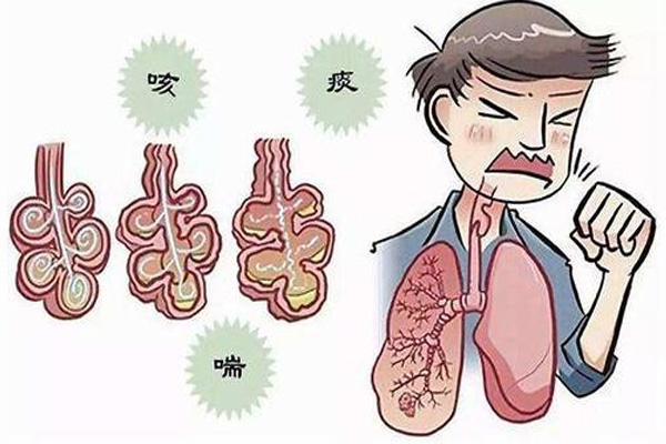 慢阻肺发作,慢阻肺发作症状,振东健康