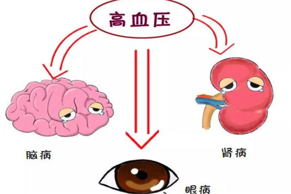 高血压,高血压症状,振东健康