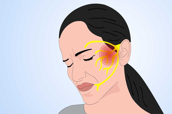 三叉神经痛症状,三叉神经痛症状的治疗,振东健康