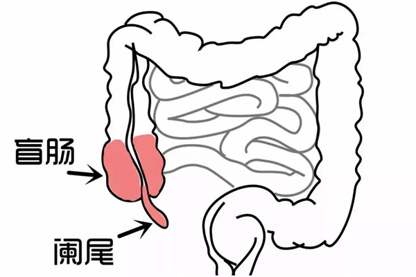 阑尾炎发作,阑尾炎发作的病因,振东健康