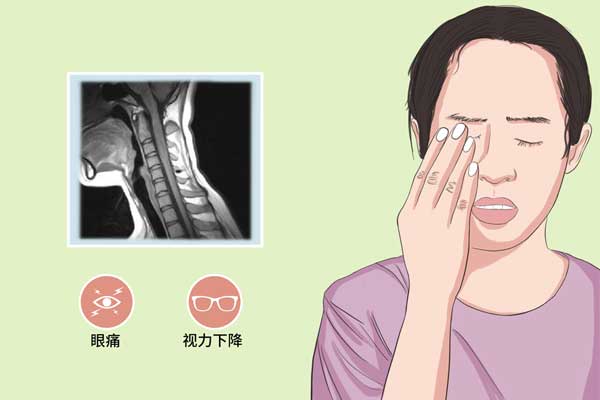 什么是视神经脊髓炎,视神经脊髓炎的症状,视神经脊髓炎的治疗方法