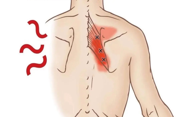 肩胛骨位置疼痛,肩胛骨位置疼痛的原因