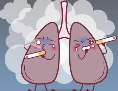 肺癌，吸烟与肺癌