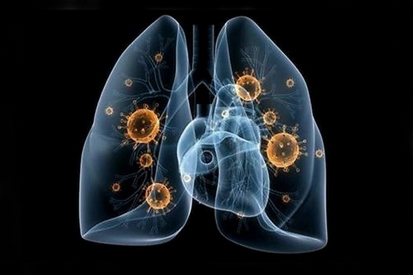 5大呼吸系统疾病,常见的呼吸系统疾病
