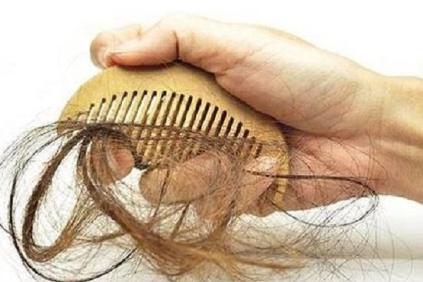 脱发,预防脱发的方法