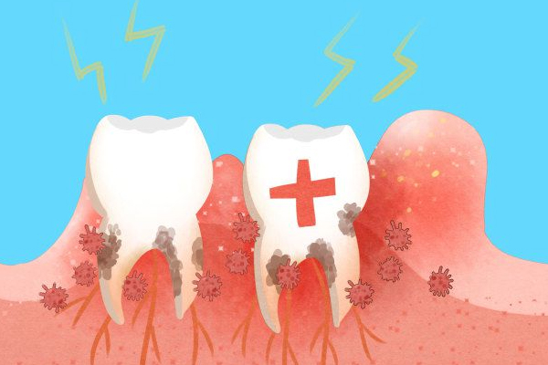 牙龈发炎,缓解牙龈发炎的方法