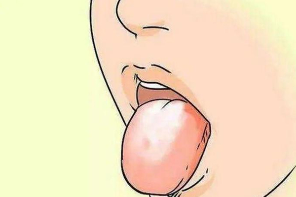 舌苔发白,舌苔发白的原因