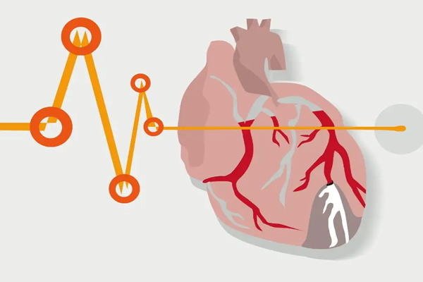 心脏早搏,心脏早搏的原因,治疗心脏早搏