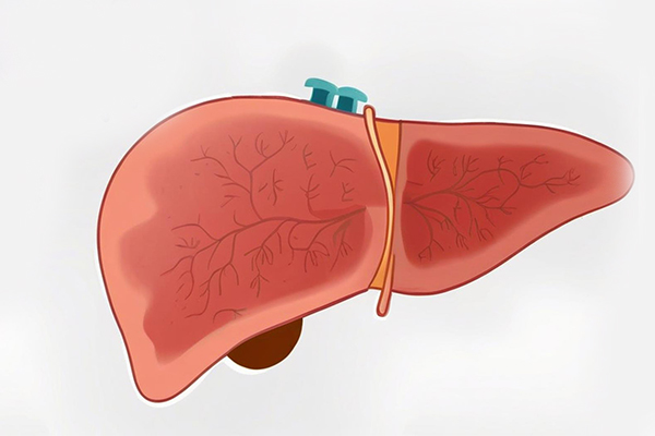 肝区疼痛是肝癌？有可能与这5大原因有关！
